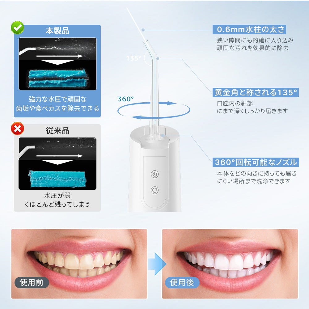 HAGOOGI(ハゴオギ) 口腔洗浄器 ウォーターフロッサー 電動 歯間洗浄器 歯垢除去率99.9% 5段階水圧調整 5種類ノズル付属 400mlタンク IPX7防水 USB充電式 携帯便利 ジェット水流 歯茎ケア 家庭用・旅行用